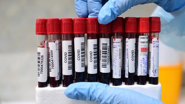 В Греции у десяти туристов обнаружили коронавирус
