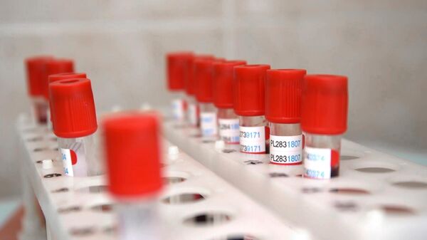 Пробирки с кровью для анализа перед выпиской добровольцев испытаний вакцины от коронавируса в Главном военном клиническом госпитале имени Н. Н. Бурденко Пробирки с кровью для анализа перед выпиской добровольцев испытаний вакцины от коронавируса в Главном военном клиническом госпитале имени Н. Н. Бурденко