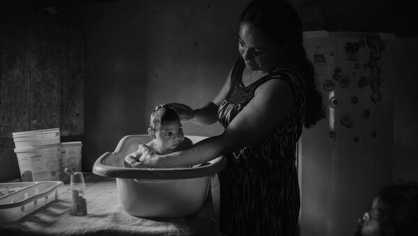 Victims of the Zika Virus фотографа Lalo de Almeida занявшего второе место в категории Проблемы современности в фотоконкурсе World Press Photo Victims of the Zika Virus фотографа Lalo de Almeida занявшего второе место в категории Проблемы современности в фотоконкурсе World Press Photo