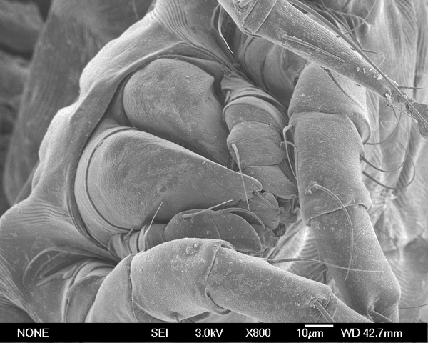 Микрофотография клеща Dermatophagoides farina Микрофотография клеща Dermatophagoides farina