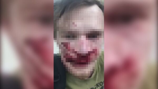 Миллеровские боксеры избивают авиаинженера из Ижевска Миллеровские боксеры избивают авиаинженера из Ижевска