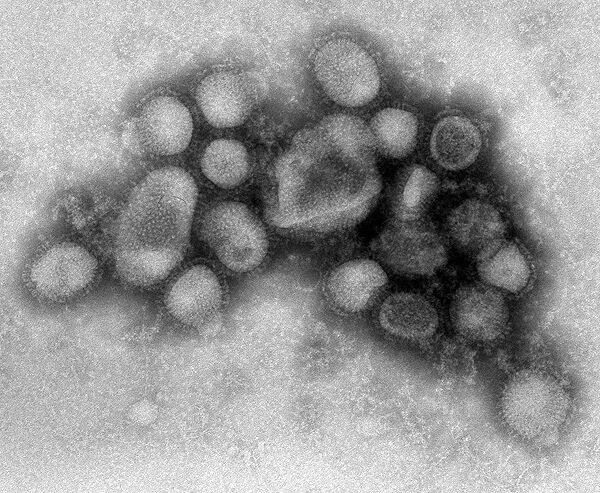 Первый случай заболевания A/H1N1 подтвержден в Боснии и Герцеговине Первый случай заболевания A/H1N1 подтвержден в Боснии и Герцеговине