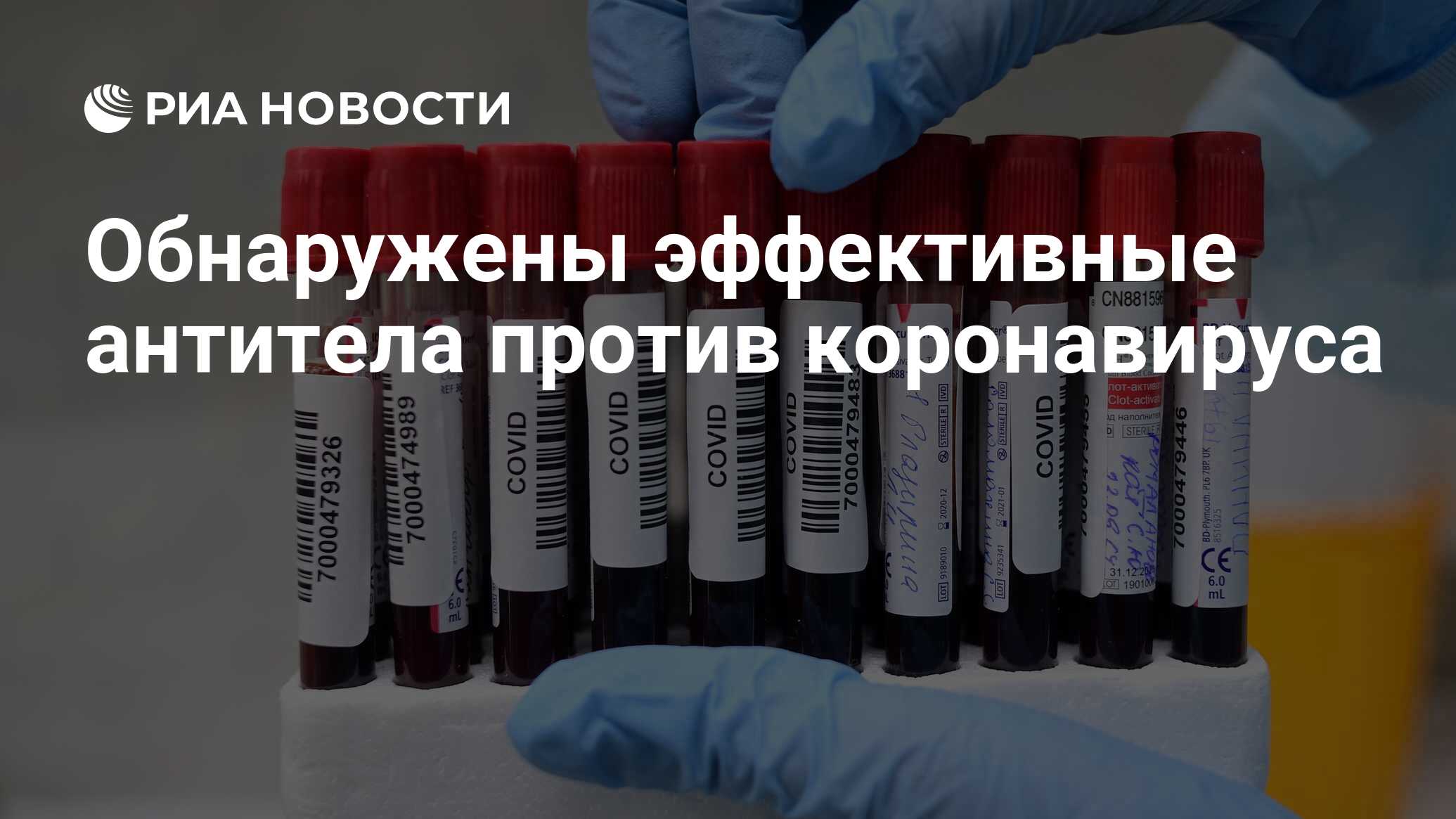 Найдены эффективные антитела против коронавируса