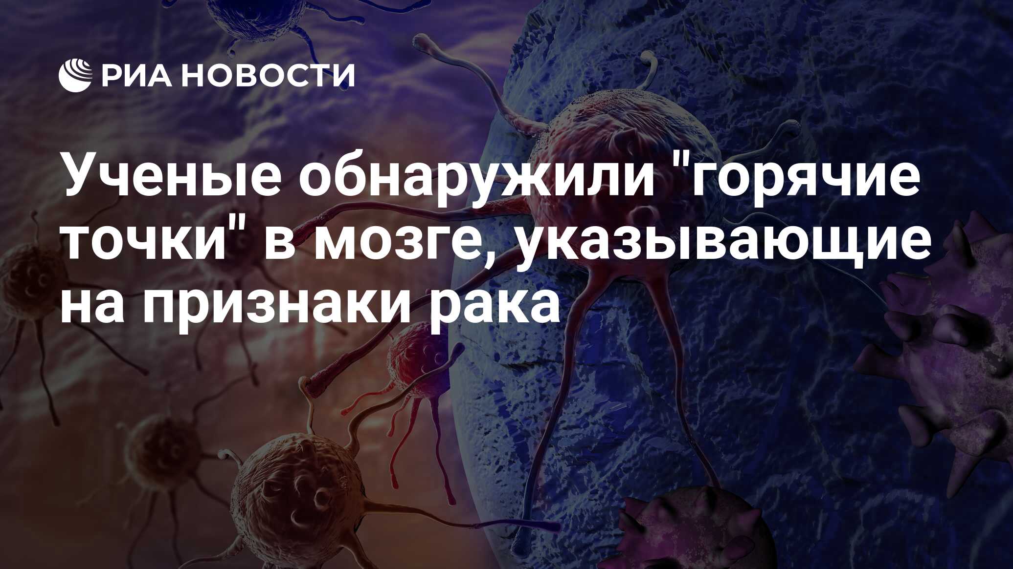 Что нашли метод. Продукты которые убивают раковые клетки. Раковые клетки в организме.